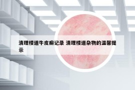 清理樓道牛皮癬記錄 清理樓道雜物的溫馨提示