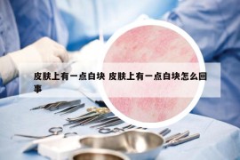 皮膚上有一點(diǎn)白塊 皮膚上有一點(diǎn)白塊怎么回事