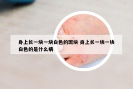 身上長一塊一塊白色的斑塊 身上長一塊一塊白色的是什么病