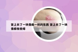 背上長了一塊像癬一樣的東西 背上長了一塊像癬有些癢