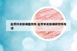 趙秀珍皮膚病醫(yī)院所 趙秀琴皮膚病研究所電話