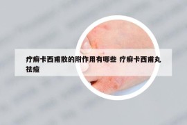 疔癬卡西甫散的附作用有哪些 療癬卡西甫丸祛痘