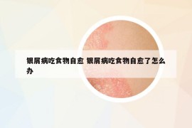 銀屑病吃食物自愈 銀屑病吃食物自愈了怎么辦