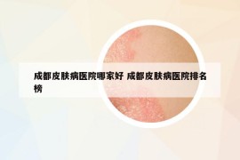 成都皮膚病醫(yī)院哪家好 成都皮膚病醫(yī)院排名榜