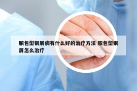 膿包型銀屑病有什么好的治療方法 膿包型銀屑怎么治療