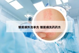銀屑病外洗單方 銀屑病洗藥藥方