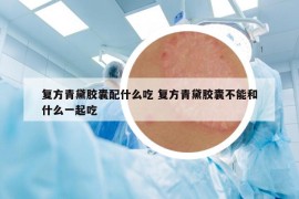 復(fù)方青黛膠囊配什么吃 復(fù)方青黛膠囊不能和什么一起吃