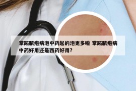 掌跖膿皰病泡中藥起的泡更多啦 掌跖膿皰病中藥好用還是西藥好用?