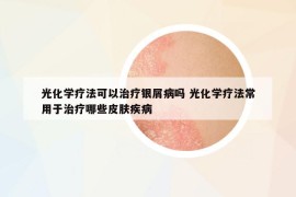 光化學(xué)療法可以治療銀屑病嗎 光化學(xué)療法常用于治療哪些皮膚疾病