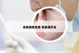皮膚癬疲憊康 膚蘚康藥膏