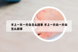 手上一片一片白怎么回事 手上一片白一片白怎么回事