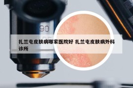 扎蘭屯皮膚病哪家醫(yī)院好 扎蘭屯皮膚病外科診所