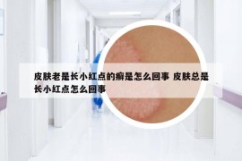 皮膚老是長(zhǎng)小紅點(diǎn)的癬是怎么回事 皮膚總是長(zhǎng)小紅點(diǎn)怎么回事