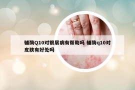 輔酶Q10對銀屑病有幫助嗎 輔酶q10對皮膚有好處嗎