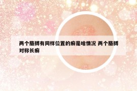 兩個胳膊有同樣位置的癬是啥情況 兩個胳膊對稱長癬