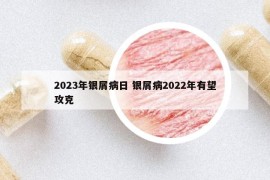 2023年銀屑病日 銀屑病2022年有望攻克