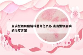 點(diǎn)滴型銀屑病鏈球菌高怎么辦 點(diǎn)滴型銀屑病的治療方案