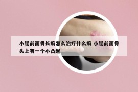 小腿前面骨長癬怎么治療什么癬 小腿前面骨頭上有一個(gè)小凸起