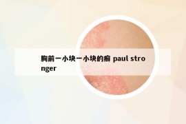 胸前一小塊一小塊的癬 paul stronger