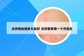 點(diǎn)狀銀血病多久能好 點(diǎn)狀銀霄病一個(gè)月痊愈
