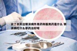 說了半天這銀消病外用藥和服用藥是什么 銀消病吃什么草藥治好呀