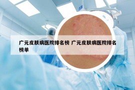 廣元皮膚病醫(yī)院排名榜 廣元皮膚病醫(yī)院排名榜單
