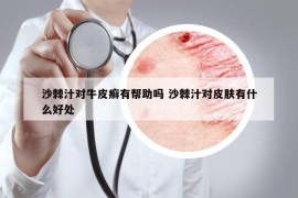 沙棘汁對牛皮癬有幫助嗎 沙棘汁對皮膚有什么好處