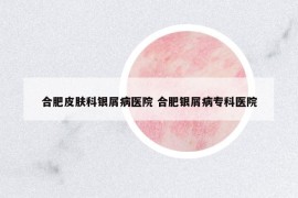 合肥皮膚科銀屑病醫(yī)院 合肥銀屑病專科醫(yī)院