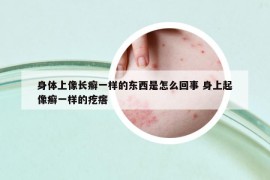 身體上像長癬一樣的東西是怎么回事 身上起像癬一樣的疙瘩
