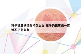 孩子銀屑病很郁悶怎么辦 孩子的銀屑病一直好不了怎么辦
