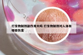 打生物制劑副作用大嗎 打生物制劑對人體有哪些傷害