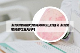 點(diǎn)滴狀銀屑病吃銀屑靈顆粒還膚組合 點(diǎn)滴型銀屑病吃消炎藥嗎