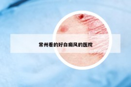 常州看的好白癜風(fēng)的醫(yī)院