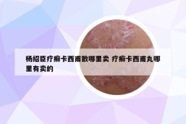 楊紹臣療癬卡西甫散哪里賣(mài) 療癬卡西甫丸哪里有賣(mài)的