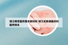 鎮(zhèn)江哪家醫(yī)院看皮膚科好 鎮(zhèn)江皮膚病最好的醫(yī)院排名