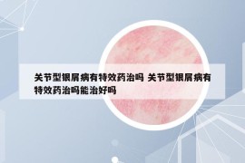 關(guān)節(jié)型銀屑病有特效藥治嗎 關(guān)節(jié)型銀屑病有特效藥治嗎能治好嗎