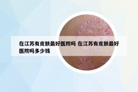 在江蘇有皮膚最好醫(yī)院嗎 在江蘇有皮膚最好醫(yī)院嗎多少錢