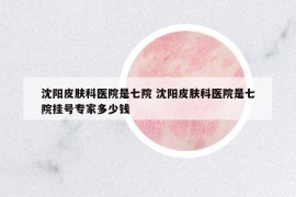 沈陽皮膚科醫(yī)院是七院 沈陽皮膚科醫(yī)院是七院掛號(hào)專家多少錢
