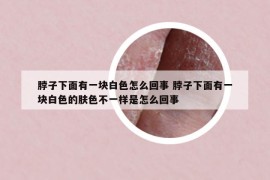脖子下面有一塊白色怎么回事 脖子下面有一塊白色的膚色不一樣是怎么回事