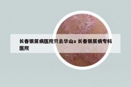 長(zhǎng)春銀屑病醫(yī)院只去華山a 長(zhǎng)春銀屑病?？漆t(yī)院