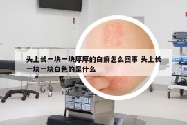 頭上長(zhǎng)一塊一塊厚厚的白癬怎么回事 頭上長(zhǎng)一塊一塊白色的是什么