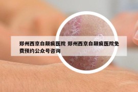 鄭州西京白顛瘋醫(yī)院 鄭州西京白顛瘋醫(yī)院免費預(yù)約公眾號咨詢