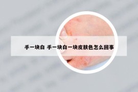 手一塊白 手一塊白一塊皮膚色怎么回事