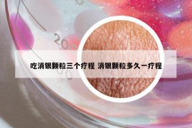 吃消銀顆粒三個(gè)療程 消銀顆粒多久一療程