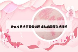 什么皮膚病需要做病理 皮膚病需要做病理嗎