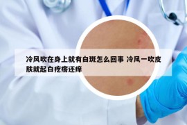冷風吹在身上就有白斑怎么回事 冷風一吹皮膚就起白疙瘩還癢
