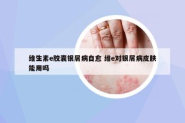 維生素e膠囊銀屑病自愈 維e對銀屑病皮膚能用嗎
