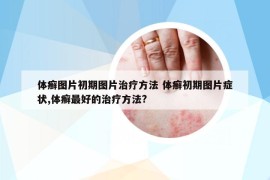 體癬圖片初期圖片治療方法 體癬初期圖片癥狀,體癬最好的治療方法?