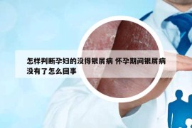 怎樣判斷孕婦的沒(méi)得銀屑病 懷孕期間銀屑病沒(méi)有了怎么回事