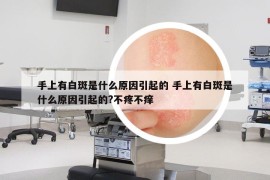 手上有白斑是什么原因引起的 手上有白斑是什么原因引起的?不疼不癢